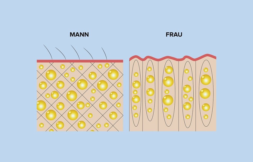 Männer cellulite Improvement in